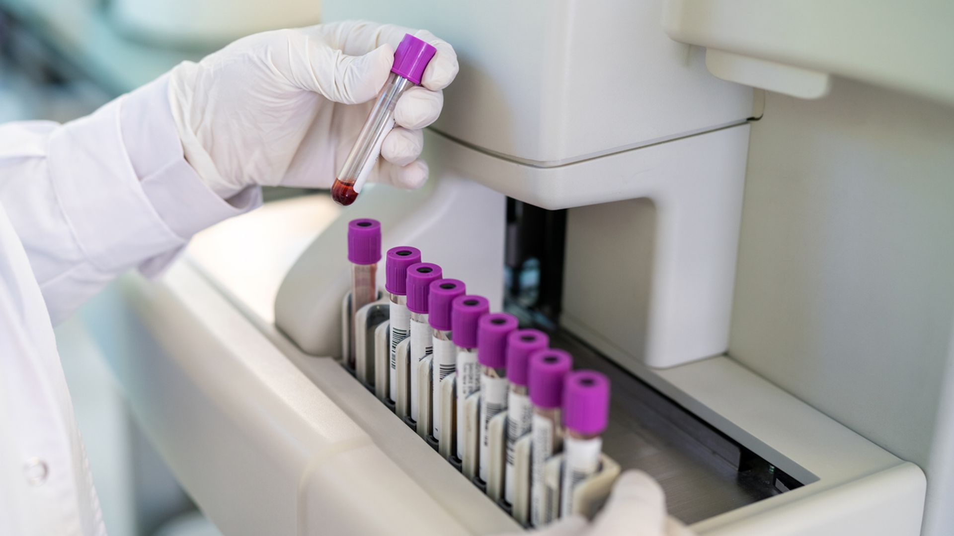 Blood test could detect Alzheimer’s signs ‘decades before symptoms appear’